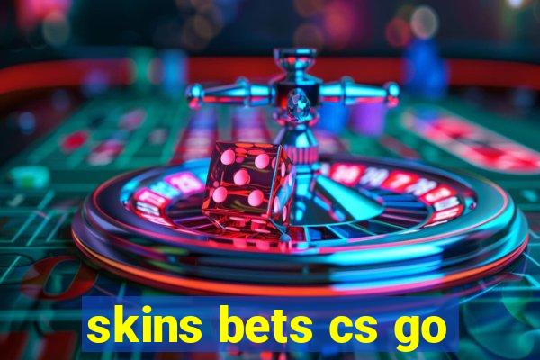 skins bets cs go