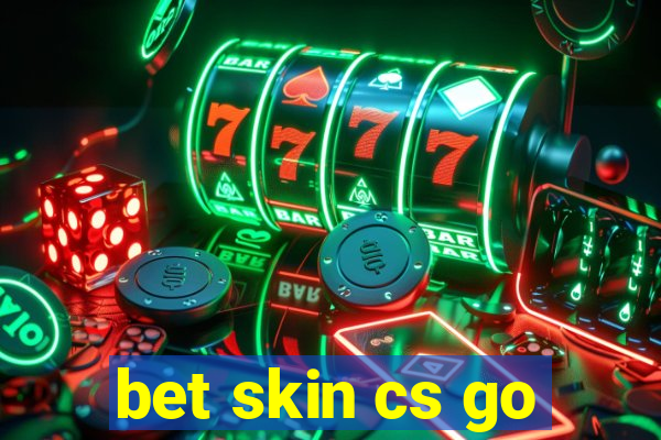 bet skin cs go